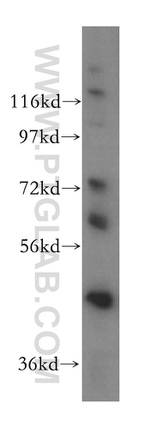 DDX43 Antibody in Western Blot (WB)