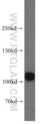 PYK2 Antibody in Western Blot (WB)