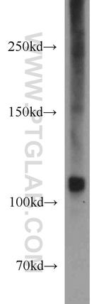 PYK2 Antibody in Western Blot (WB)