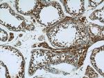 EXOC5 Antibody in Immunohistochemistry (Paraffin) (IHC (P))