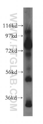 EXOC5 Antibody in Western Blot (WB)