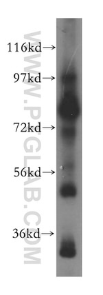 EXOC5 Antibody in Western Blot (WB)