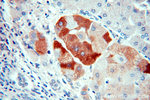 SMYD4 Antibody in Immunohistochemistry (Paraffin) (IHC (P))