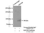 SMYD4 Antibody in Immunoprecipitation (IP)