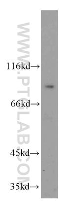 SMYD4 Antibody in Western Blot (WB)