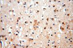 NDUFB2 Antibody in Immunohistochemistry (Paraffin) (IHC (P))