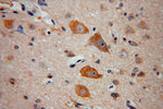 NDUFB2 Antibody in Immunohistochemistry (Paraffin) (IHC (P))