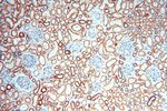 NDUFB2 Antibody in Immunohistochemistry (Paraffin) (IHC (P))