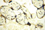 NDUFB2 Antibody in Immunohistochemistry (Paraffin) (IHC (P))