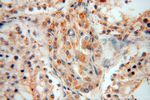 NDUFB2 Antibody in Immunohistochemistry (Paraffin) (IHC (P))