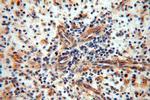 NDUFB2 Antibody in Immunohistochemistry (Paraffin) (IHC (P))