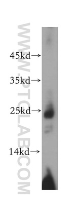 CD3 Antibody in Western Blot (WB)