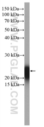 CD3 Antibody in Western Blot (WB)