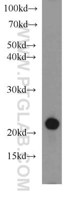 CD3 Antibody in Western Blot (WB)