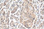 SBDS Antibody in Immunohistochemistry (Paraffin) (IHC (P))