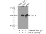 SBDS Antibody in Immunoprecipitation (IP)