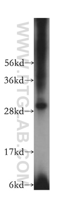 SBDS Antibody in Western Blot (WB)