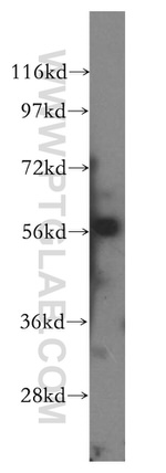 CD127/IL7R Antibody in Western Blot (WB)