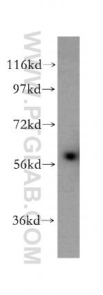 CD127/IL7R Antibody in Western Blot (WB)