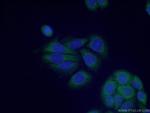 PRMT3 Antibody in Immunocytochemistry (ICC/IF)