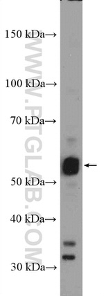 RORB Antibody in Western Blot (WB)