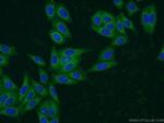 EHBP1 Antibody in Immunocytochemistry (ICC/IF)