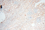 EHBP1 Antibody in Immunohistochemistry (Paraffin) (IHC (P))