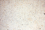 EHBP1 Antibody in Immunohistochemistry (Paraffin) (IHC (P))