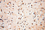 EHBP1 Antibody in Immunohistochemistry (Paraffin) (IHC (P))