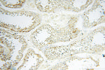 EHBP1 Antibody in Immunohistochemistry (Paraffin) (IHC (P))