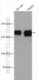 EHBP1 Antibody in Western Blot (WB)