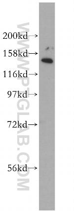 EHBP1 Antibody in Western Blot (WB)