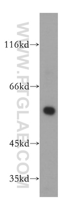 HMGCS1 Antibody in Western Blot (WB)