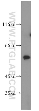 HMGCS1 Antibody in Western Blot (WB)