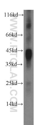 IL-12B Antibody in Western Blot (WB)