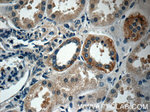 PAAF1 Antibody in Immunohistochemistry (Paraffin) (IHC (P))