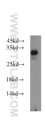 PAAF1 Antibody in Western Blot (WB)