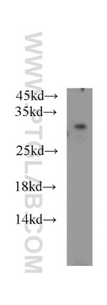 PAAF1 Antibody in Western Blot (WB)