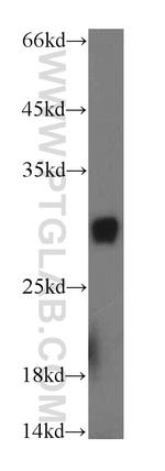 PAAF1 Antibody in Western Blot (WB)