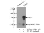 SENP3 Antibody in Immunoprecipitation (IP)