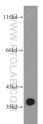 MFAP4 Antibody in Western Blot (WB)