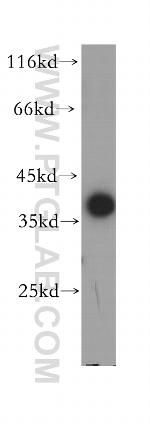MFAP4 Antibody in Western Blot (WB)