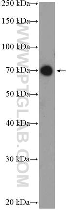 UTP6 Antibody in Western Blot (WB)