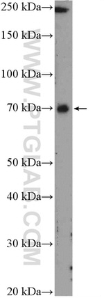 UTP6 Antibody in Western Blot (WB)