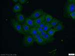 VPS4B Antibody in Immunocytochemistry (ICC/IF)