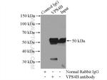 VPS4B Antibody in Immunoprecipitation (IP)