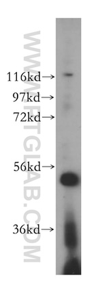 VPS4B Antibody in Western Blot (WB)