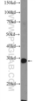 MSX1 Antibody in Western Blot (WB)