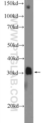 MSX1 Antibody in Western Blot (WB)