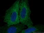 AHNAK2 Antibody in Immunocytochemistry (ICC/IF)